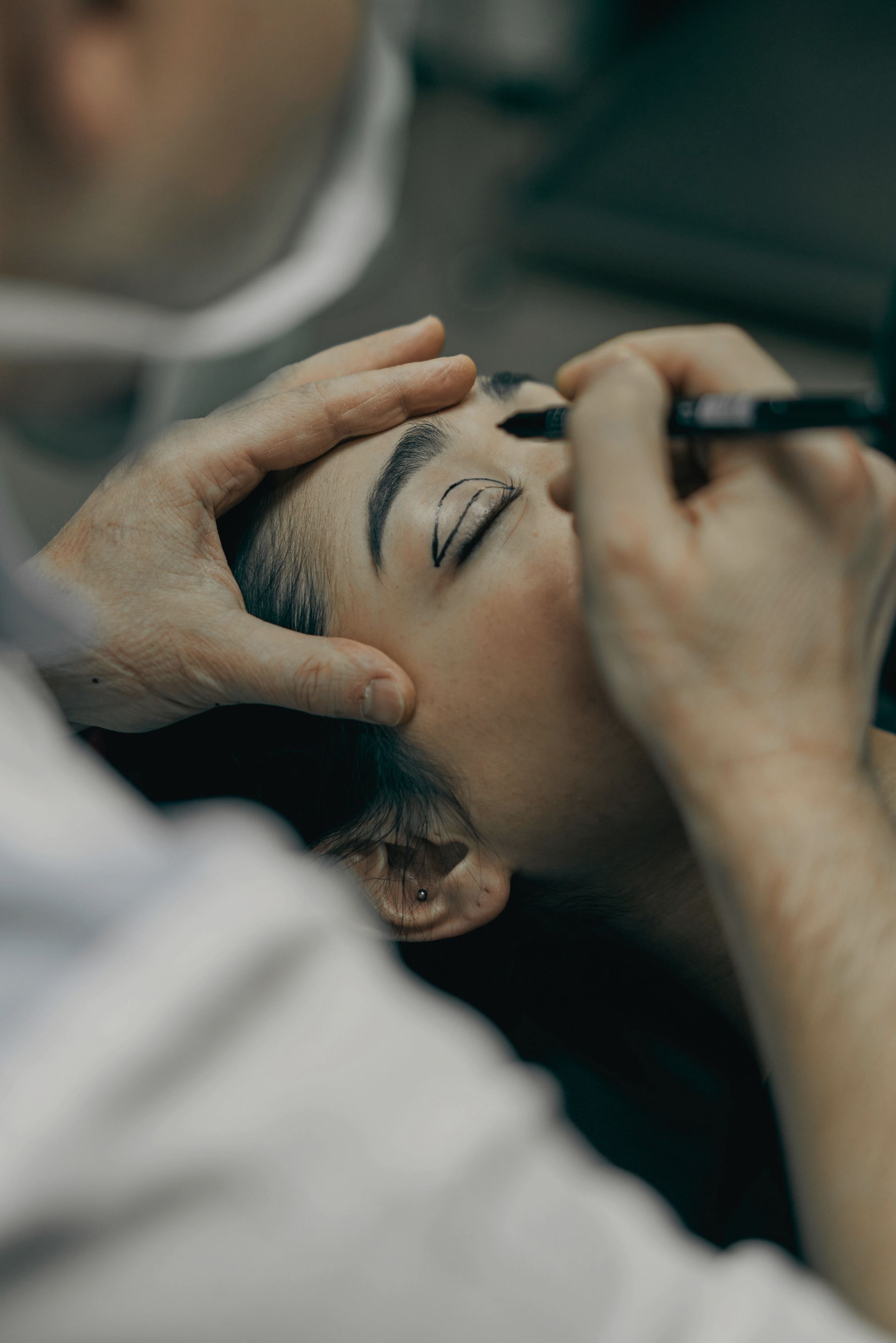 Blepharoplasty
