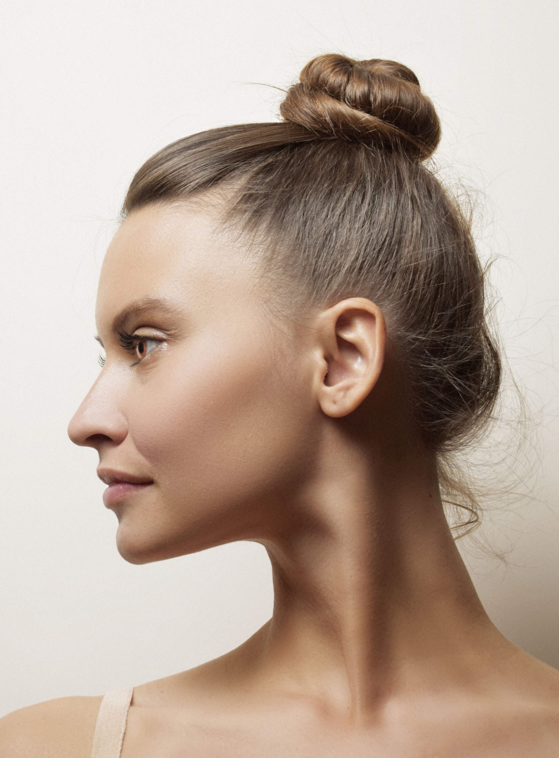 Otoplasty