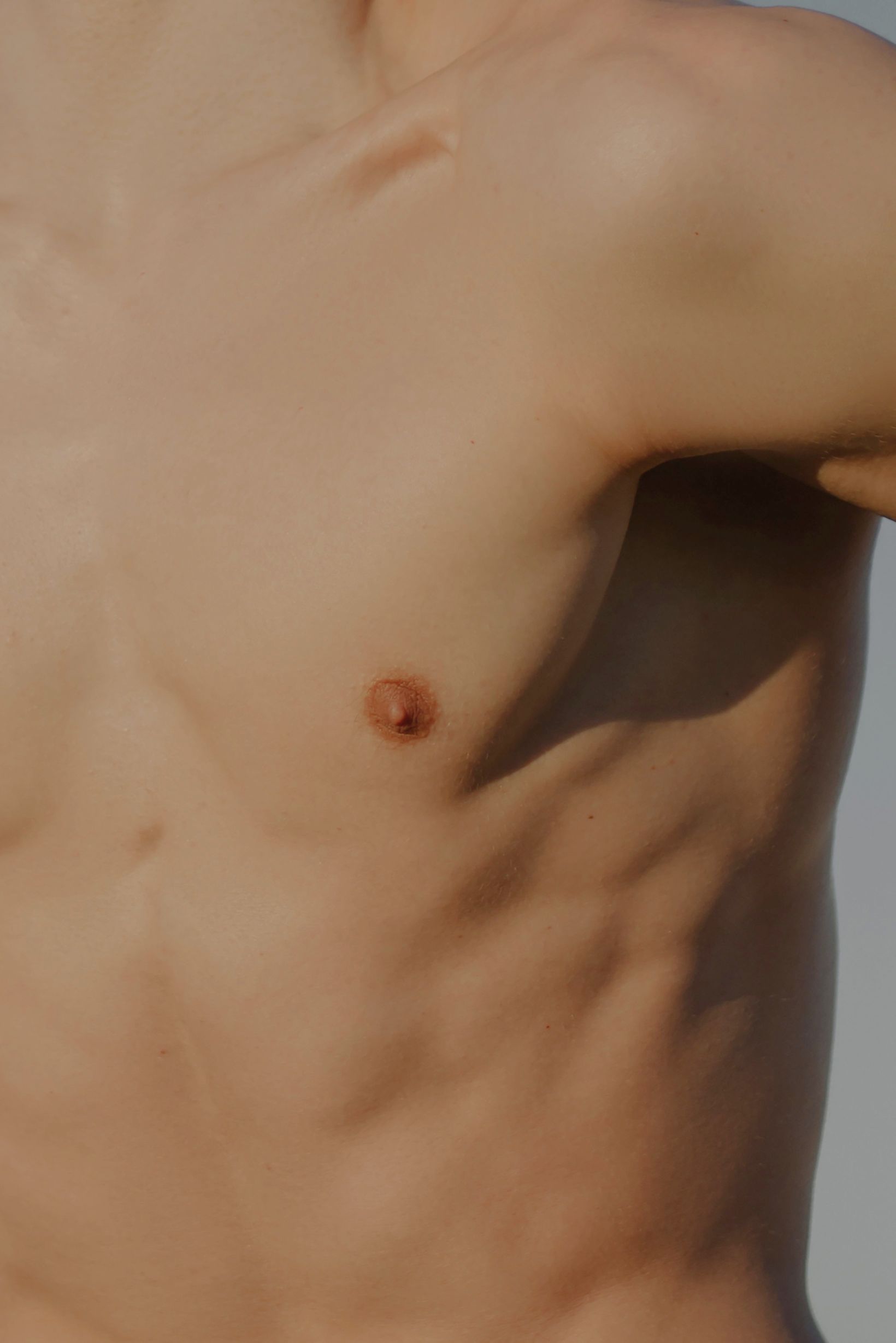 Gynecomastia Surgery