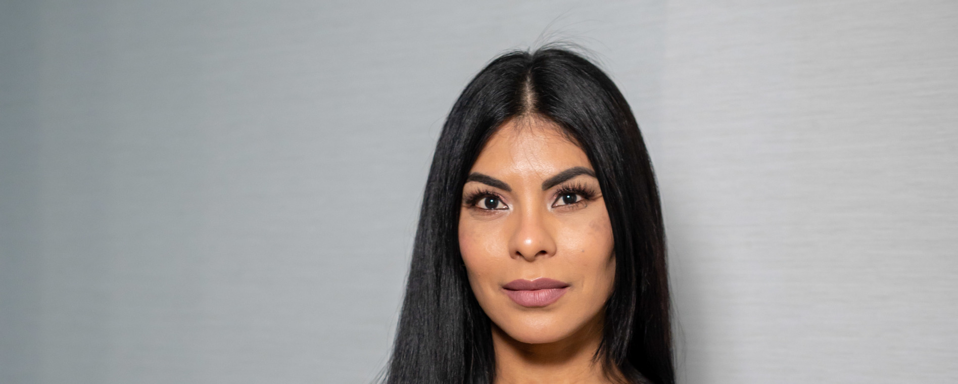 Adriana, Surgery Team